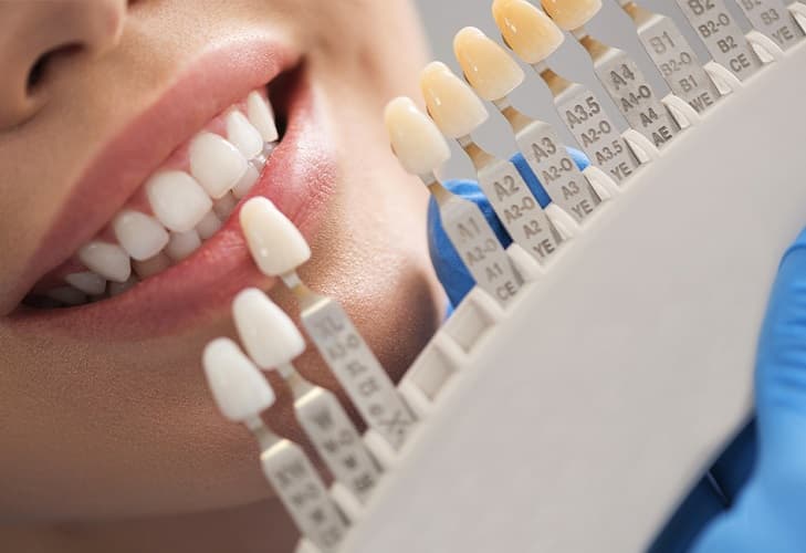 Zirconia Crowns & Bridges