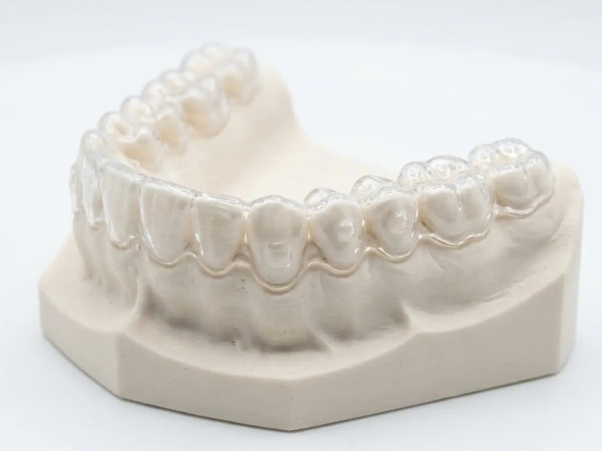 In-House Clear Aligners